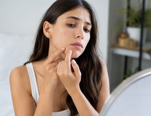 Pourquoi certaines imperfections semblent-elles suivre le rythme du cycle menstruel ?